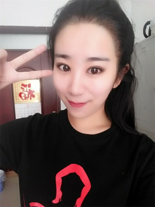 【分享案例】给宝宝们分享我的双眼皮之路啦!宝宝们我做双眼皮是打的局麻,其实局麻一点都不痛就跟蚊子叮差不多,不是特别注意完完全全就感觉不到