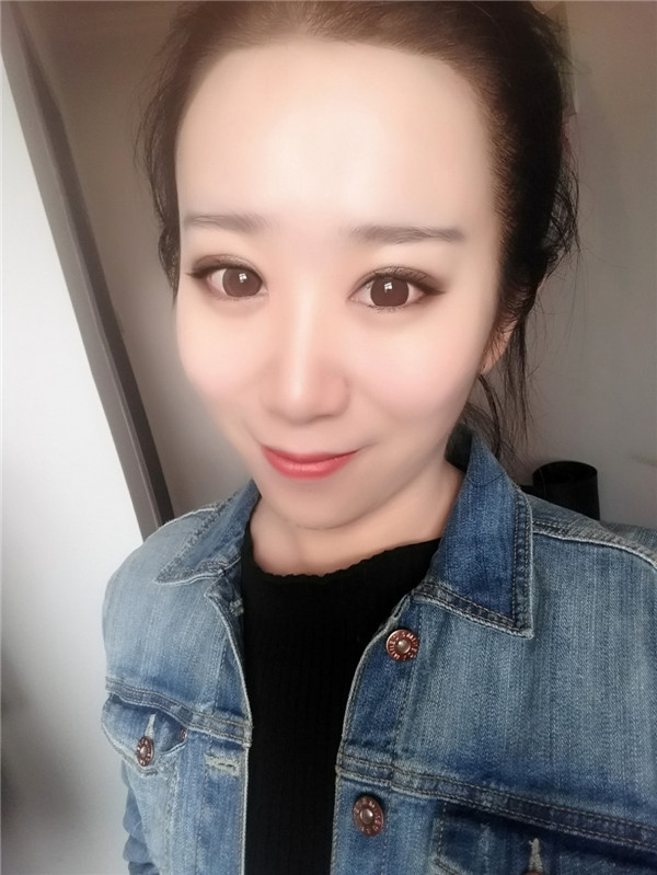 【分享案例】给宝宝们分享我的双眼皮之路啦!宝宝们我做双眼皮是打的局麻,其实局麻一点都不痛就跟蚊子叮差不多,不是特别注意完完全全就感觉不到