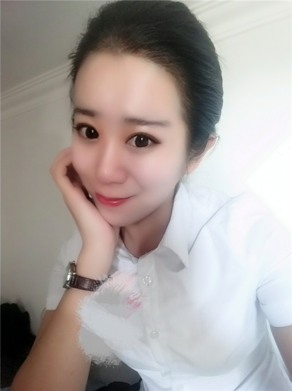 【分享案例】给宝宝们分享我的双眼皮之路啦!宝宝们我做双眼皮是打的局麻,其实局麻一点都不痛就跟蚊子叮差不多,不是特别注意完完全全就感觉不到