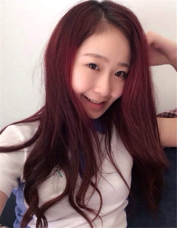 马上就要到情人节了,做啦面部填充后我就可以美美哒去约会啦O(∩_∩)O哈哈~,进来看看我的面部填充案例吧小可爱们~~~~~~~~
