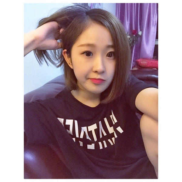 马上就要到情人节了,做啦面部填充后我就可以美美哒去约会啦O(∩_∩)O哈哈~,进来看看我的面部填充案例吧小可爱们~~~~~~~~
