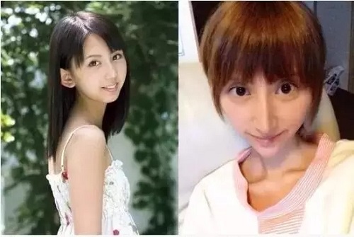 较容易被人忽视的一个部位:下巴!