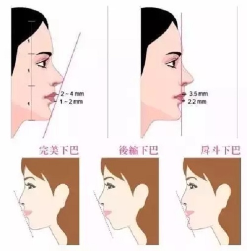 较容易被人忽视的一个部位:下巴!