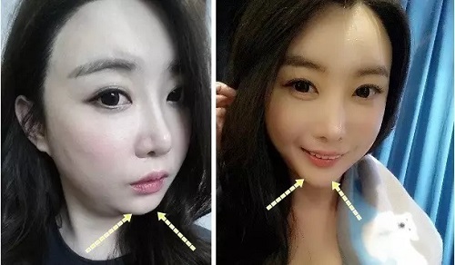 较容易被人忽视的一个部位:下巴!