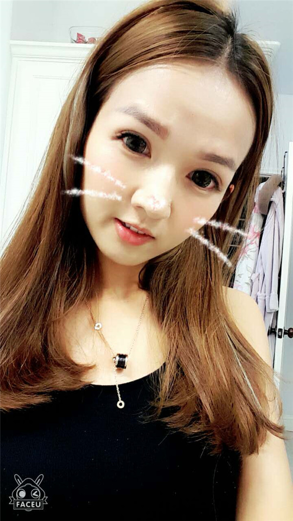 【全切+祛皮祛脂】分享我的术后恢复小妙招!宝宝们刚做完手术的前几天因为眼睛肿胀的厉害会比较丑,过了这几天后期慢慢消肿会越来越自然的。