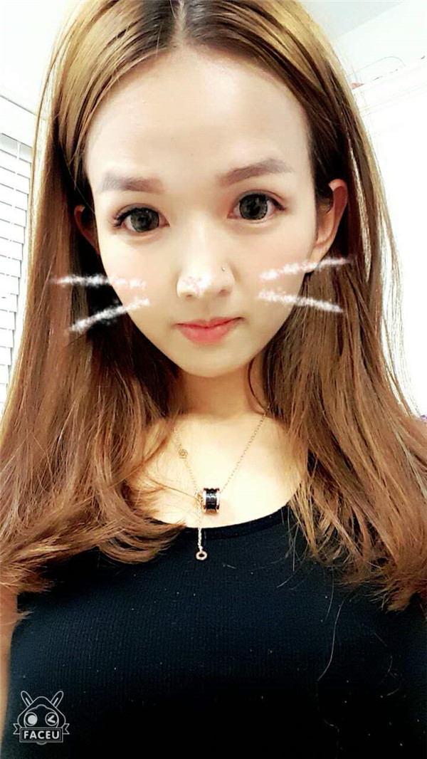 【全切+祛皮祛脂】分享我的术后恢复小妙招!宝宝们刚做完手术的前几天因为眼睛肿胀的厉害会比较丑,过了这几天后期慢慢消肿会越来越自然的。