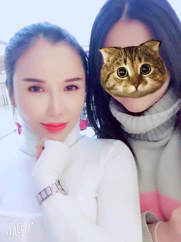 【鼻部手术】小仙女们,做完手术第一天就迫不及待想把自己这次的经历分享给大家了~~~我先放一些我的照片让宝宝们看看我的恢复情况