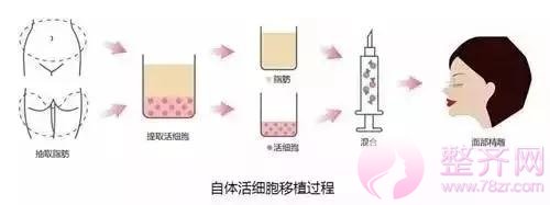 脂肪填充,小小脂肪,大大作用