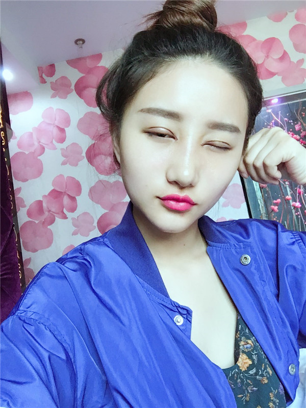 【双眼皮+隆鼻术】春节长假过完啦,亲朋好友们都夸我变漂亮了,一条精致的线,就能够让眼睛瞬间变大、变亮、变漂亮!