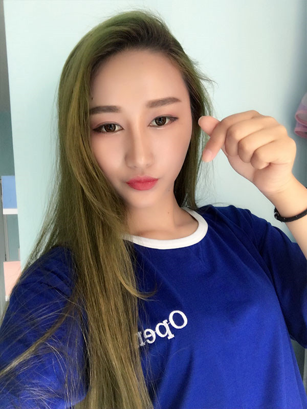【双眼皮+隆鼻术】春节长假过完啦,亲朋好友们都夸我变漂亮了,一条精致的线,就能够让眼睛瞬间变大、变亮、变漂亮!