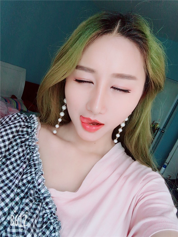 【双眼皮+隆鼻术】春节长假过完啦,亲朋好友们都夸我变漂亮了,一条精致的线,就能够让眼睛瞬间变大、变亮、变漂亮!