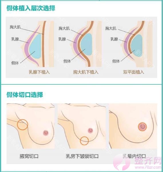 女孩的咪咪真的能“摸摸大”吗?