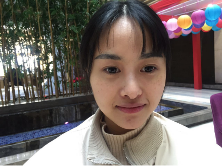 北京知音埋线提升提升一个月案例分享,做一个漂亮全新的自己。