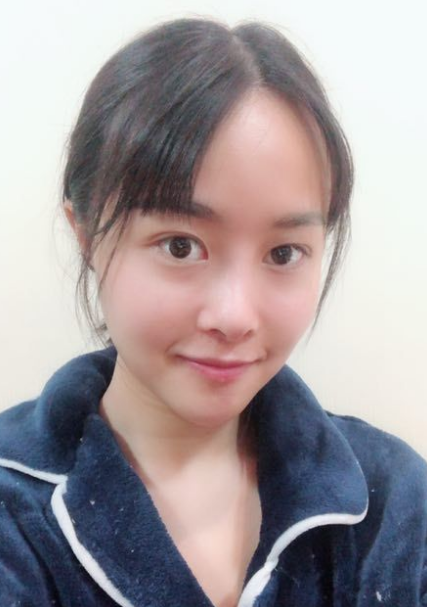 北京知音埋线提升提升一个月案例分享,做一个漂亮全新的自己。