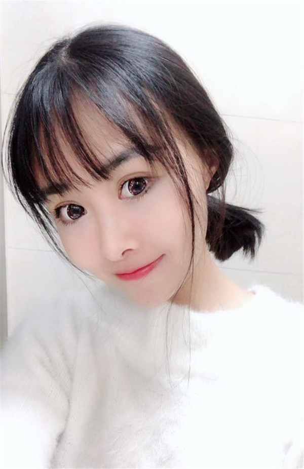 北京知音埋线提升提升一个月案例分享,做一个漂亮全新的自己。