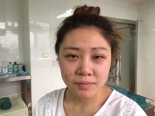 漂亮鼻子,完美侧颜杀