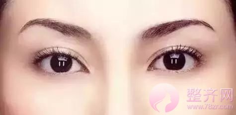 为什么亚洲人不适合做宽的双眼皮?