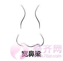 鼻部手术改变9种典型丑鼻子