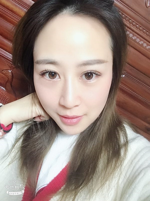 三月春光好,我来给小姐妹们分享我的切开双眼皮经历啦~~~我现在还不到30,要抓紧时间美美美!!