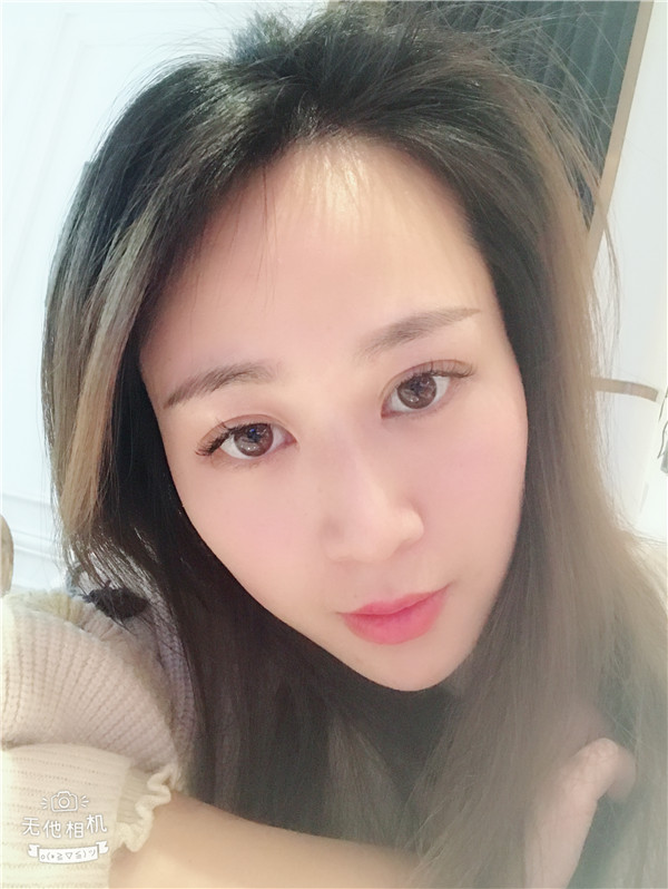 三月春光好,我来给小姐妹们分享我的切开双眼皮经历啦~~~我现在还不到30,要抓紧时间美美美!!