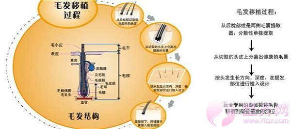 不要担心无法拥有“北极星”绿,植发来帮你