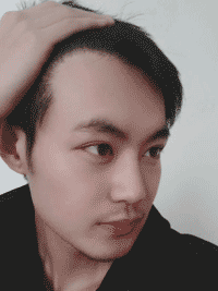 不要担心无法拥有“北极星”绿,植发来帮你