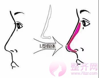 想要一副盛世美颜,没有漂亮的鼻子怎么行?