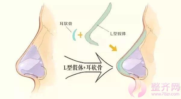 想要一副盛世美颜,没有漂亮的鼻子怎么行?