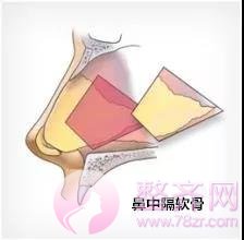 想要一副盛世美颜,没有漂亮的鼻子怎么行?
