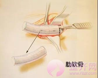 想要一副盛世美颜,没有漂亮的鼻子怎么行?