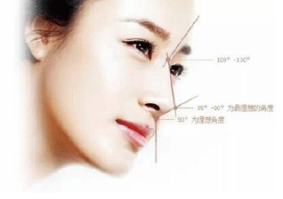 假体隆鼻哪种材料好?价格多少钱?