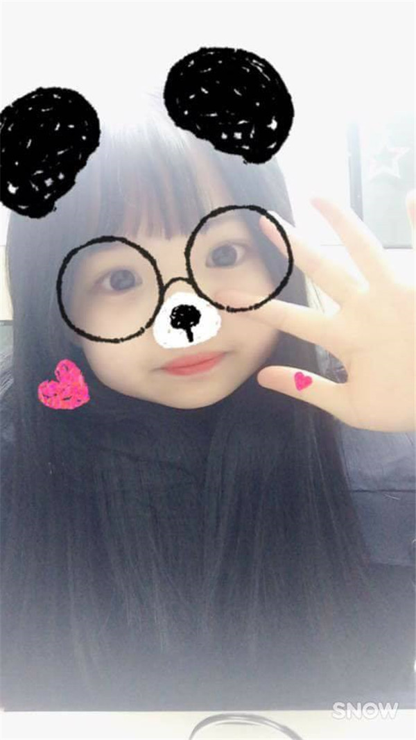宝宝们,今天我是第一次来和大家分享我的自体脂肪填充脸部的经历,大家都进来看看为我点个赞吧!