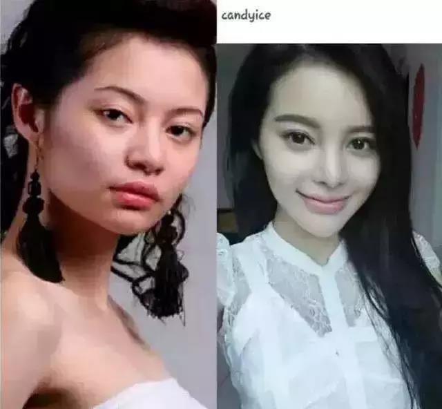 看这些网红的眼睛,就知道她们整形前后变化有
