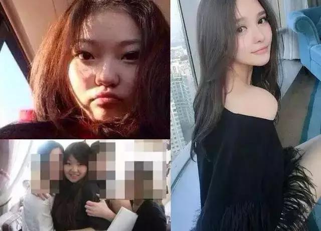 看这些网红的眼睛,就知道她们整形前后变化有