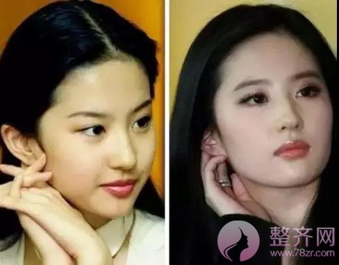 做了眉毛 你才会明白 你本来就很美!!!