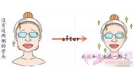 什么脸型适合做下颌角整形?