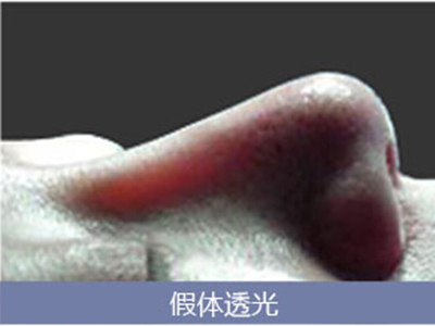 这些关于隆鼻的“小白”问题,你也可能问过