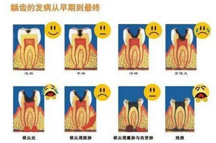 如果没有牙齿你会怎样?