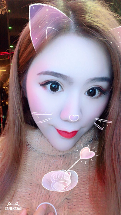 杭州美莱切开双眼皮分享,自从做了真的觉得轻松了很多,希望对大家有帮助O(∩_∩)O