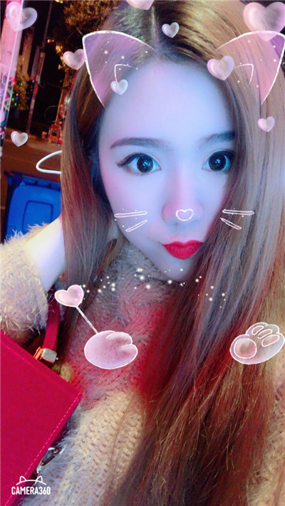 杭州美莱切开双眼皮分享,自从做了真的觉得轻松了很多,希望对大家有帮助O(∩_∩)O