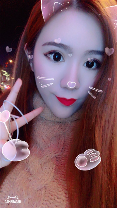 杭州美莱切开双眼皮分享,自从做了真的觉得轻松了很多,希望对大家有帮助O(∩_∩)O