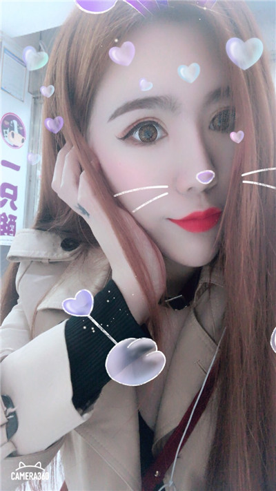 杭州美莱切开双眼皮分享,自从做了真的觉得轻松了很多,希望对大家有帮助O(∩_∩)O