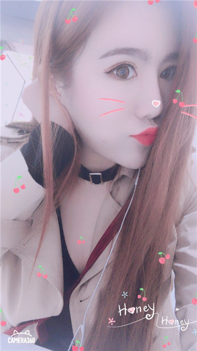 杭州美莱切开双眼皮分享,自从做了真的觉得轻松了很多,希望对大家有帮助O(∩_∩)O