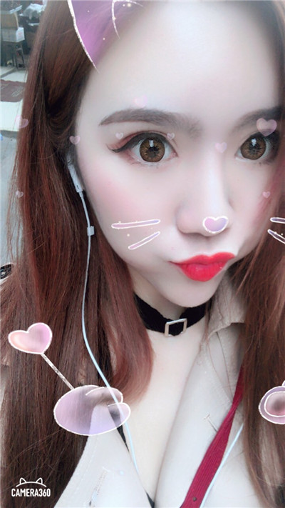 杭州美莱切开双眼皮分享,自从做了真的觉得轻松了很多,希望对大家有帮助O(∩_∩)O