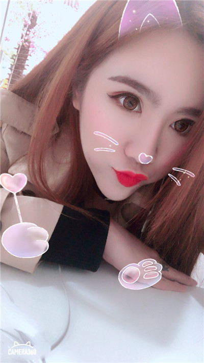 杭州美莱切开双眼皮分享,自从做了真的觉得轻松了很多,希望对大家有帮助O(∩_∩)O