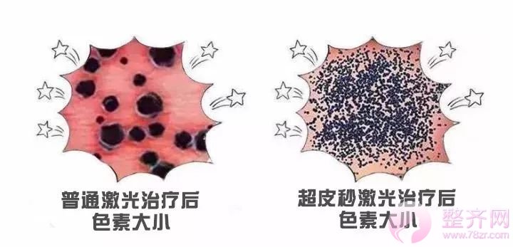 超激光美肤,带你揭开明星们的净肤秘密!
