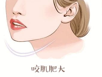 医生推荐我打进口注射瘦脸,里面会不会有猫腻?