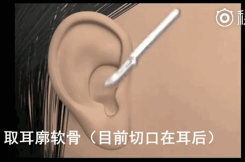 眼下流行的韩式小翘鼻,你真能hold的住吗?