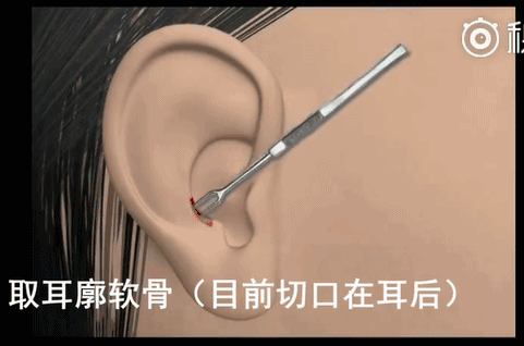 眼下流行的韩式小翘鼻,你真能hold的住吗?