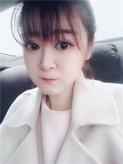 成都艺星光纤溶脂瘦脸经历分享,大脸猫变成小V脸